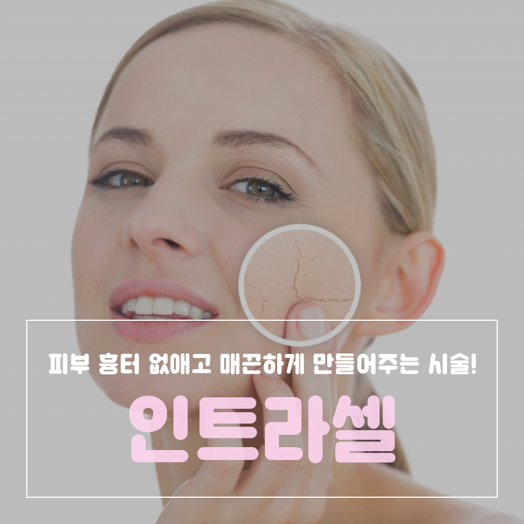 강릉피부관리 피부 흉터 없애는 인트라셀 시술로